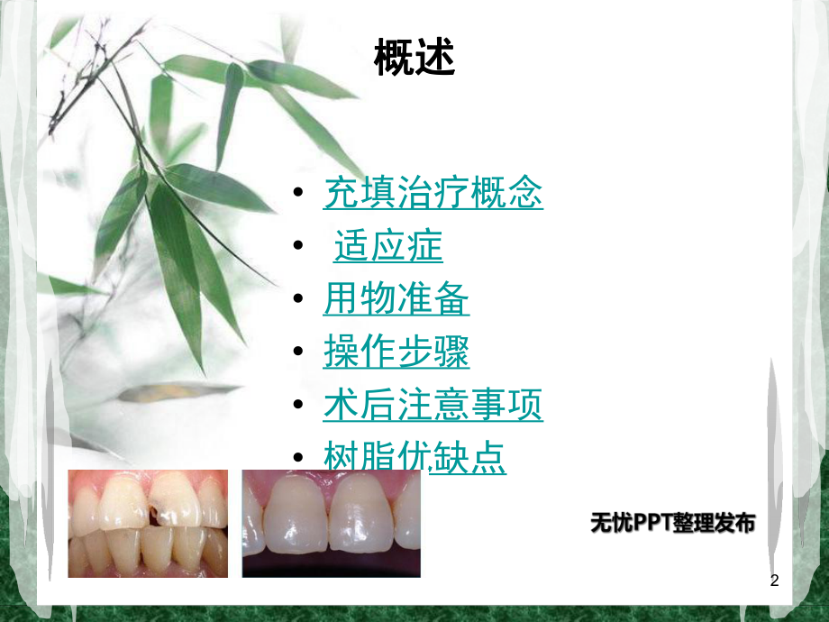 光固化复合树脂充填术(课堂)课件.ppt_第2页