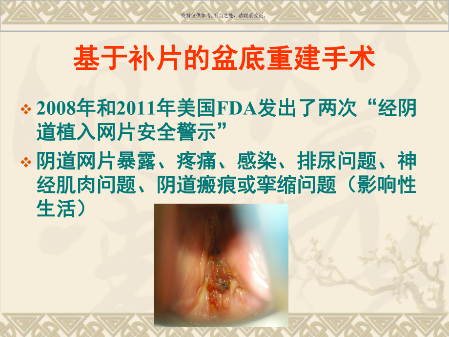 利用自身组织治疗课件.ppt_第3页