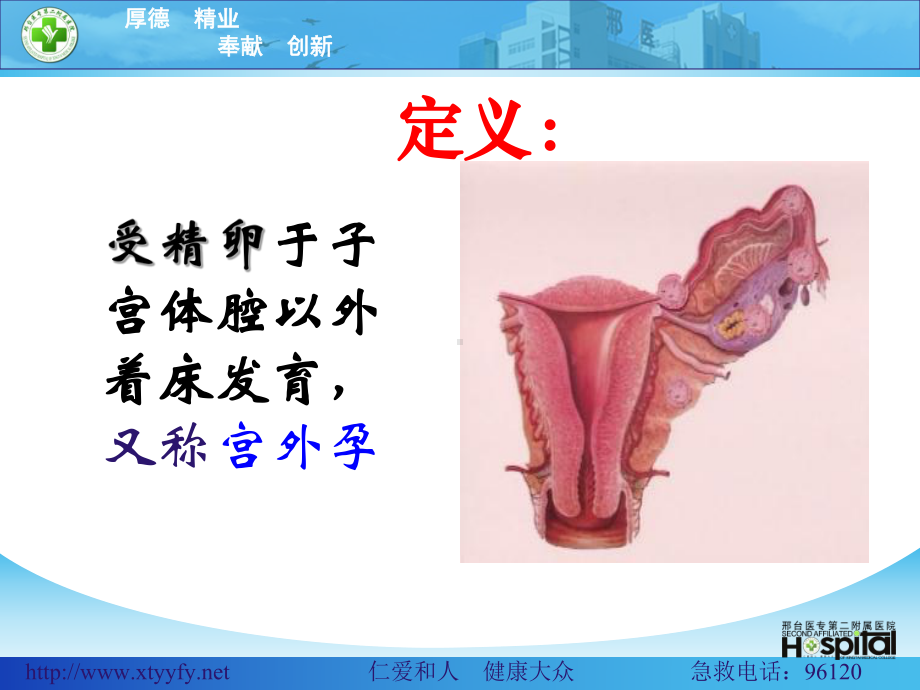 宫外孕的护理课件-2.ppt_第2页