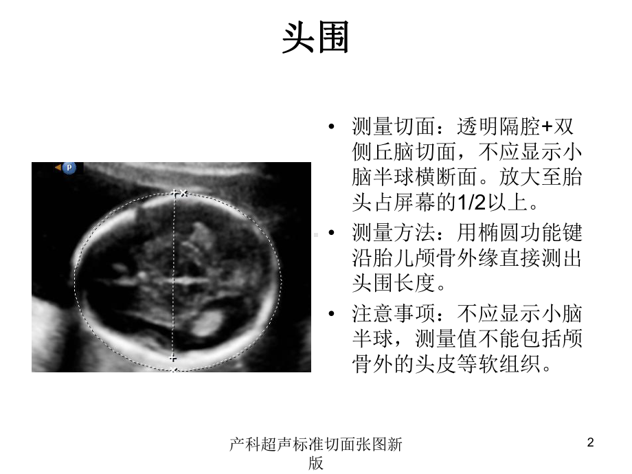 产科超声标准切面张图新版培训课件.ppt_第2页