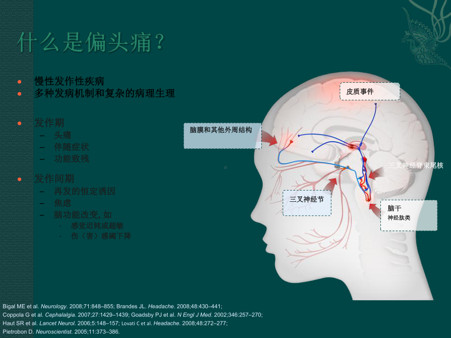 偏头痛病理生理课件.ppt_第3页