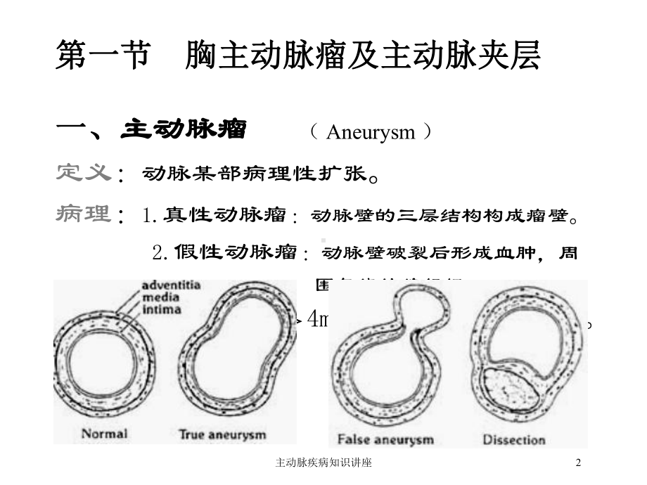 主动脉疾病知识讲座培训课件.ppt_第2页