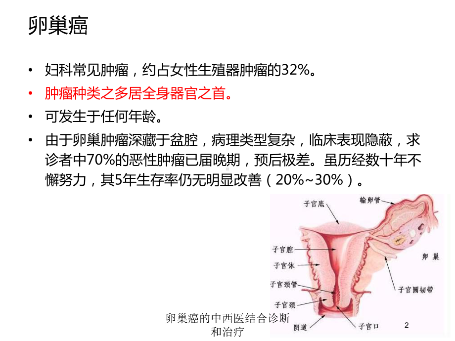 卵巢癌的中西医结合诊断和治疗培训课件.ppt_第2页