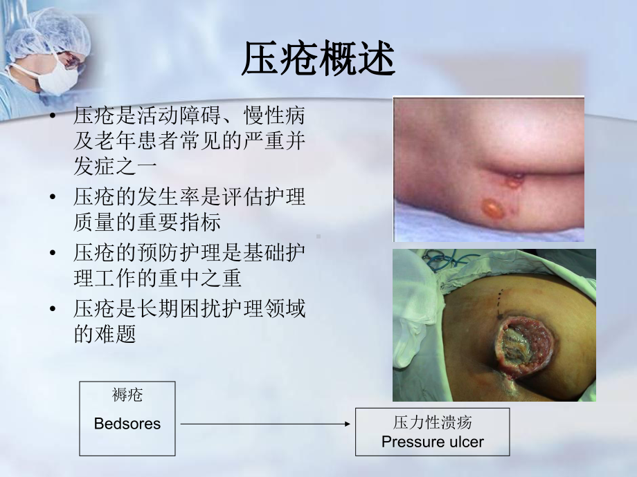 压疮护理进展及指南课件-2.ppt_第3页