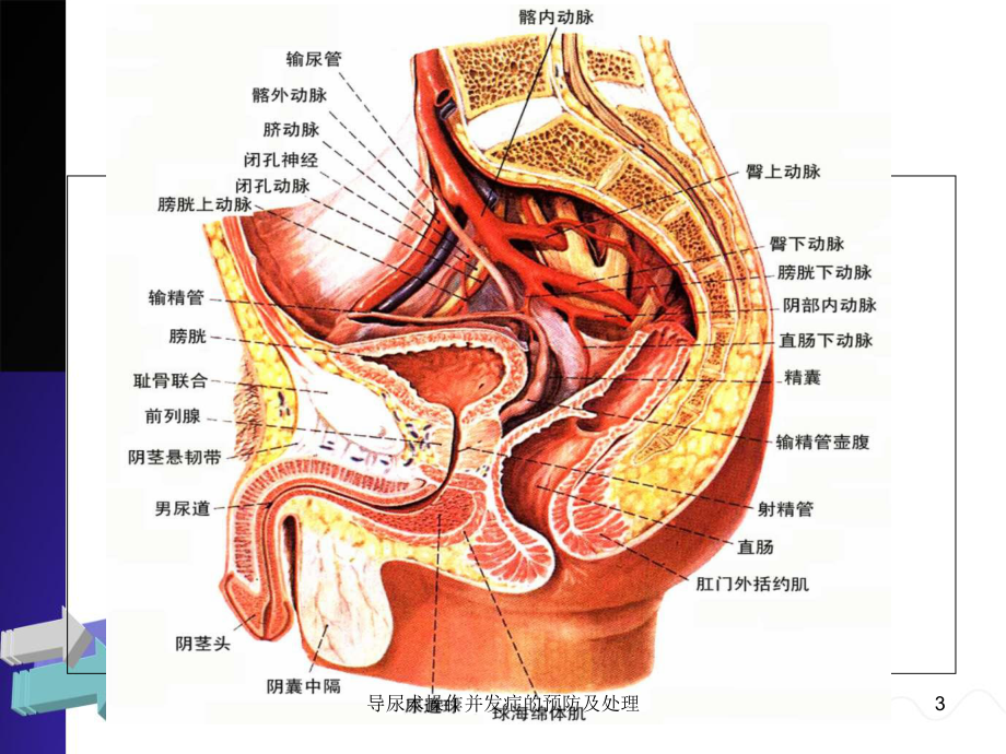 导尿术操作并发症的预防及处理培训课件.ppt_第3页