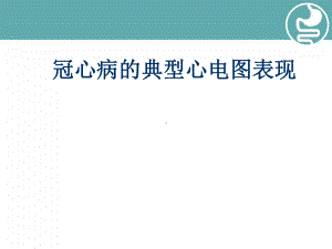 冠心病的典型心电图表现教学课件.ppt