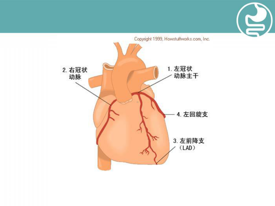 冠心病的典型心电图表现教学课件.ppt_第3页