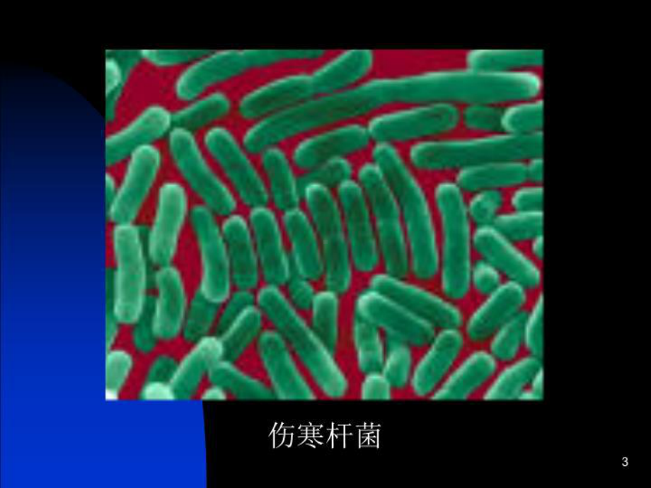 伤寒1(中西上课)gai-课件.ppt_第3页