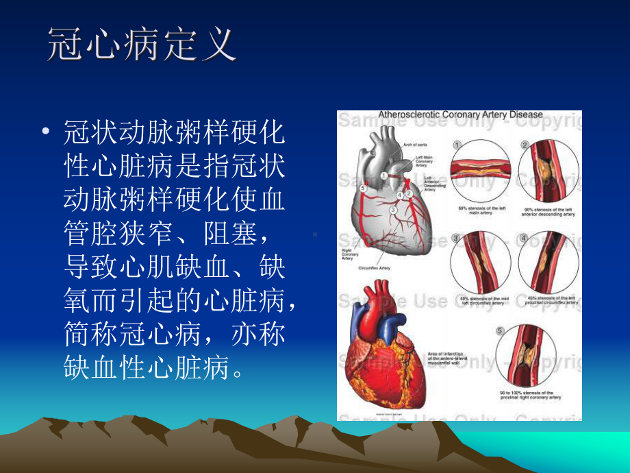 医学课件冠状动脉粥样硬化性心脏病冠心病病例讨论.ppt_第1页