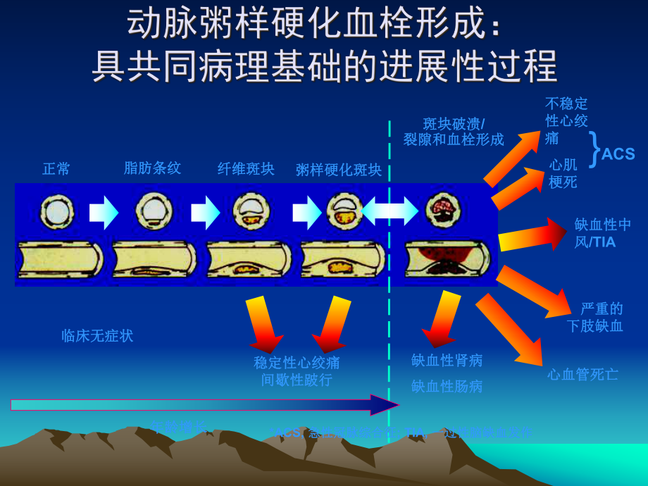 医学课件冠状动脉粥样硬化性心脏病冠心病病例讨论.ppt_第3页