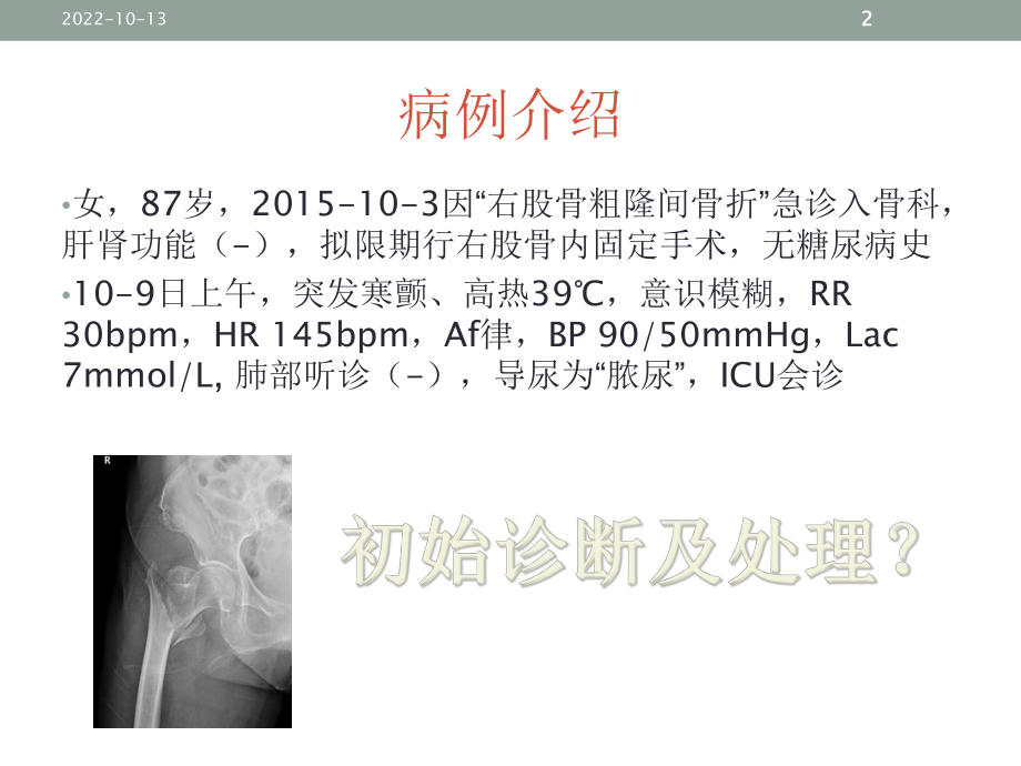 医学泌尿系脓毒症的诊断与治疗专题培训课件.ppt_第2页