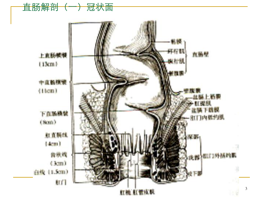 大肠肛管疾病病人的护理医学课件.pptx_第3页