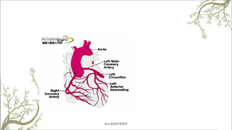 冠心病的护理课件.ppt_第2页