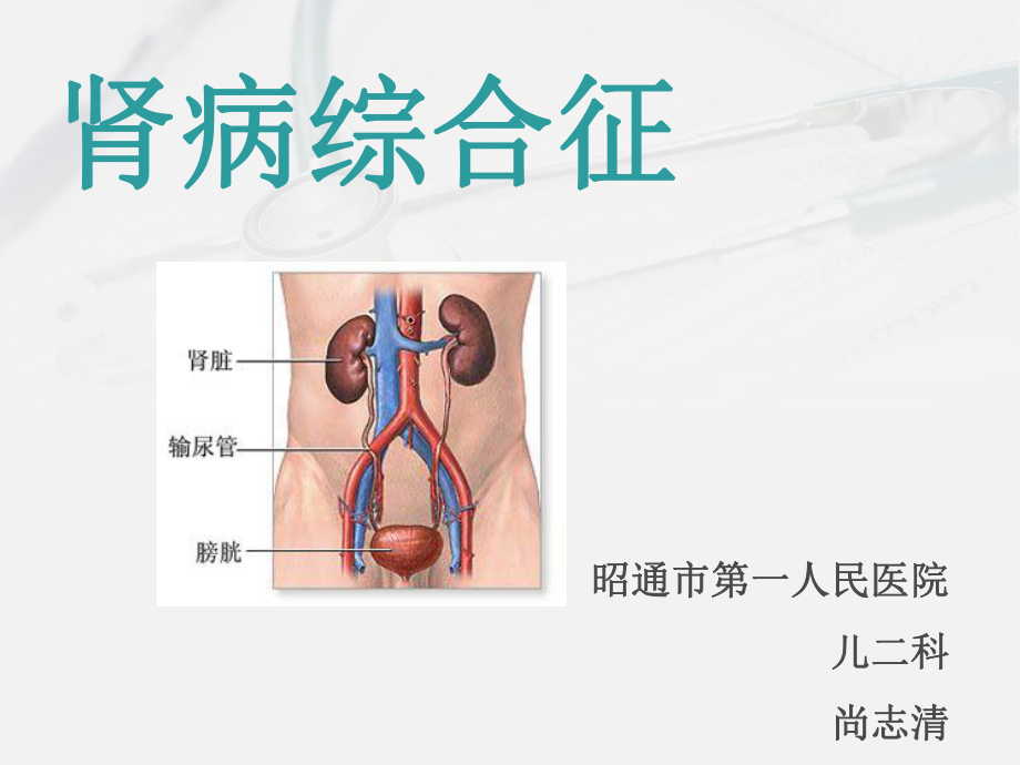 小儿肾病综合征课件.pptx_第2页