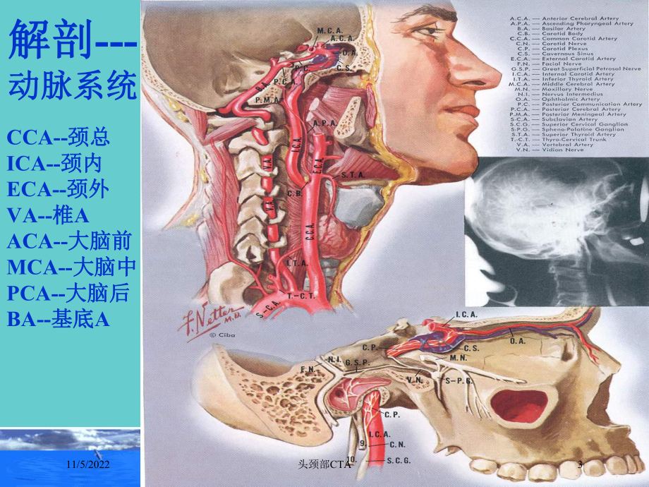 头颈部CTA培训课件.ppt_第3页