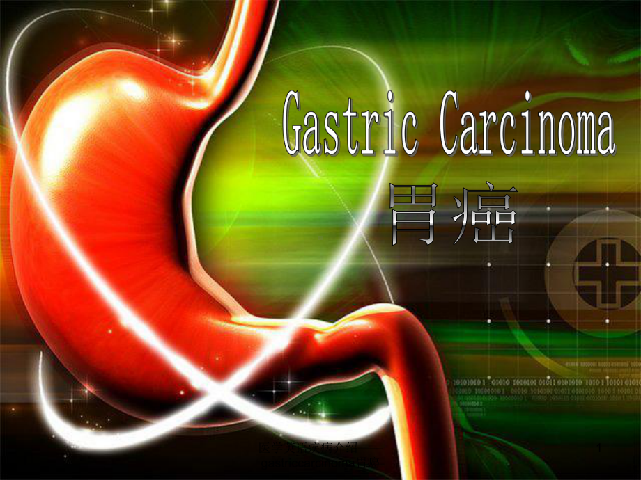 医学英语疾病介绍-gastriccarcinoma胃癌课件.ppt_第1页