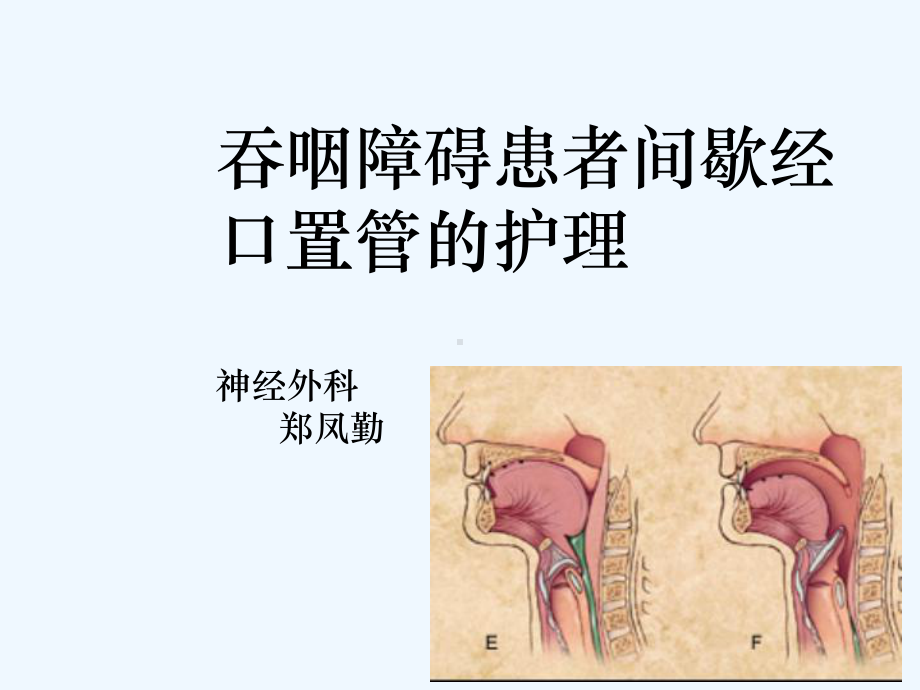 吞咽障碍护理课件.ppt_第1页