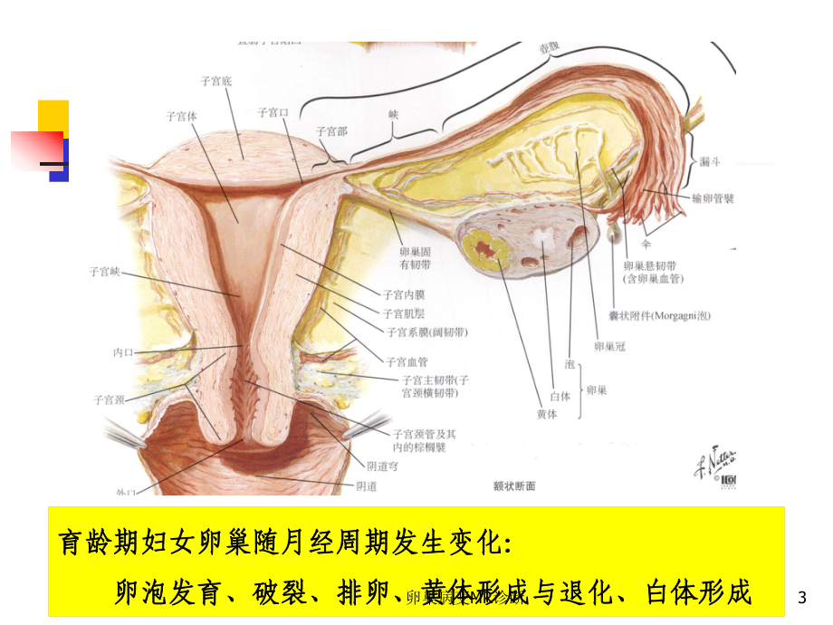 卵巢病变MR诊断培训课件.ppt_第3页