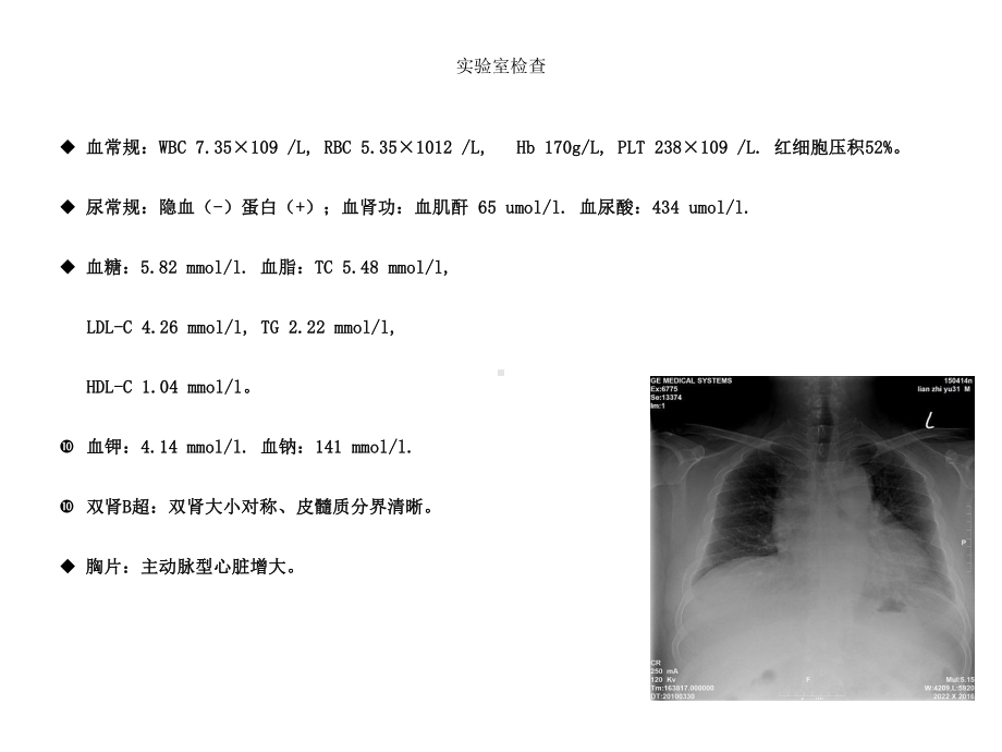 对OSAS相关性高血压的认识及发生机制的研究课件.ppt_第3页