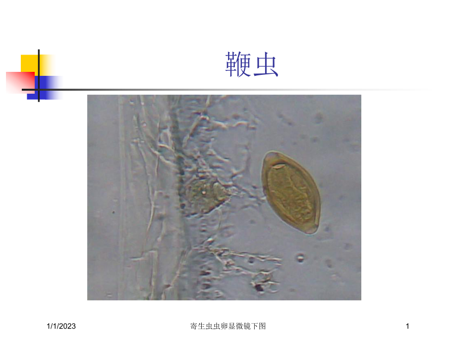 寄生虫虫卵显微镜下图课件.ppt_第1页