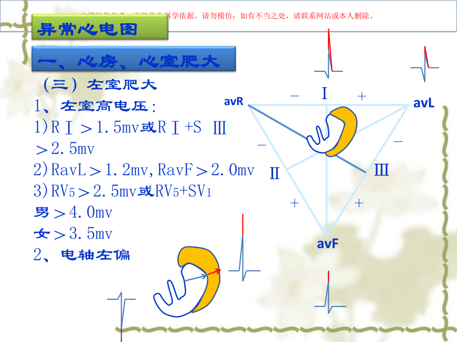 实验诊疗学异常心电图检查培训课件.ppt_第3页