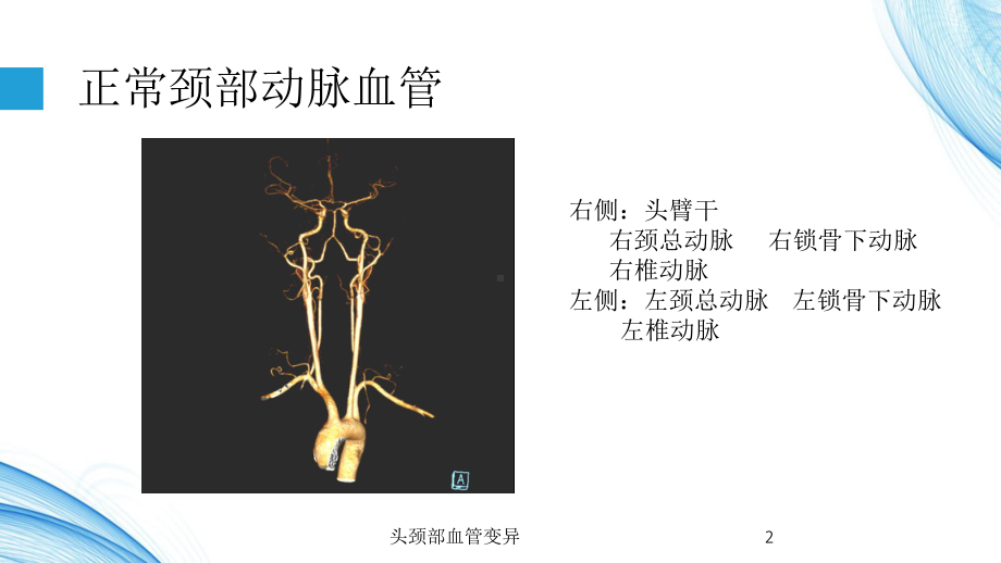 头颈部血管变异培训课件.ppt_第2页