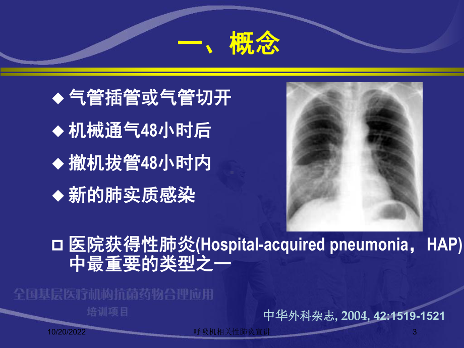 呼吸机相关性肺炎宣讲培训课件.ppt_第3页