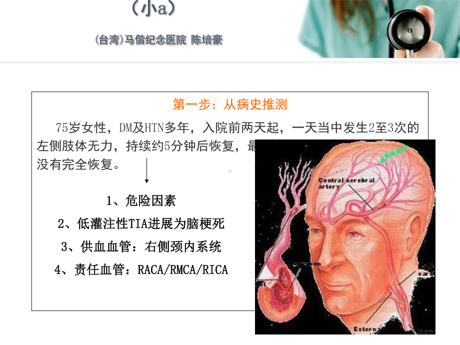 从影像学梗死部位推测责任供血血管教学课件.ppt_第2页