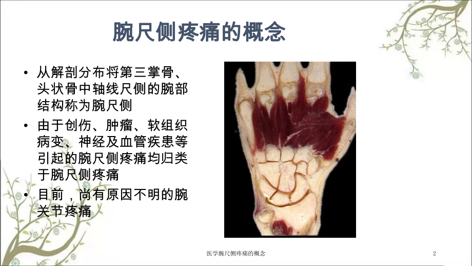 医学腕尺侧疼痛的概念课件.ppt_第2页