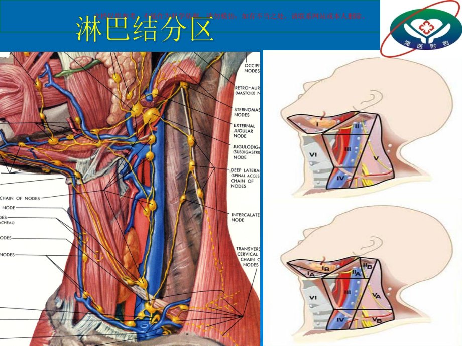 双颈功能性淋巴结清扫术的经验课件.ppt_第2页