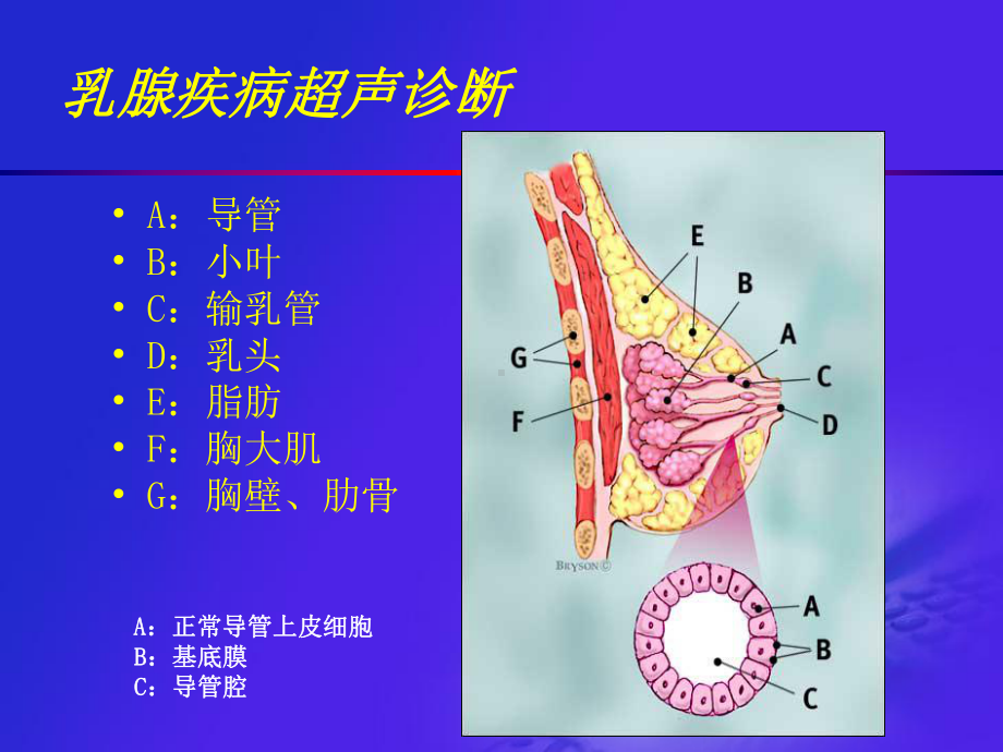 乳腺疾病超声诊断-课件.ppt_第3页