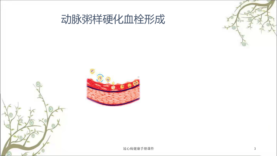 冠心病健康手册课件.ppt_第3页