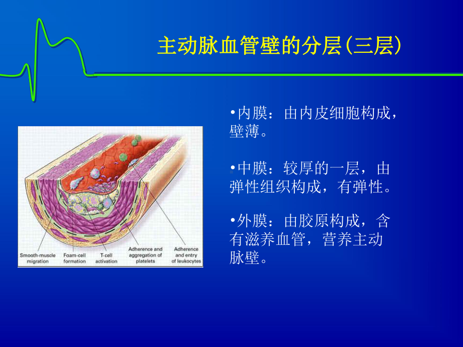 主动脉夹层课件.pptx_第2页