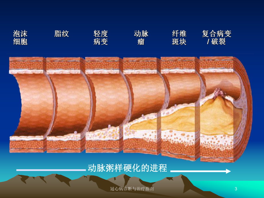 冠心病诊断与治疗指南培训课件.ppt_第3页