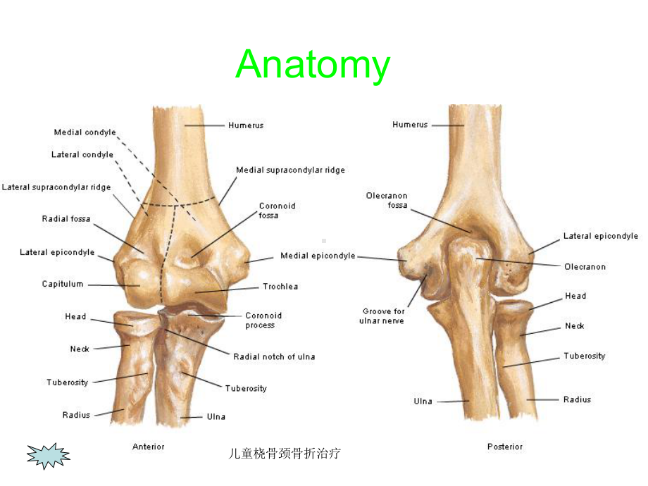 儿童桡骨颈骨折治疗课件.ppt_第2页