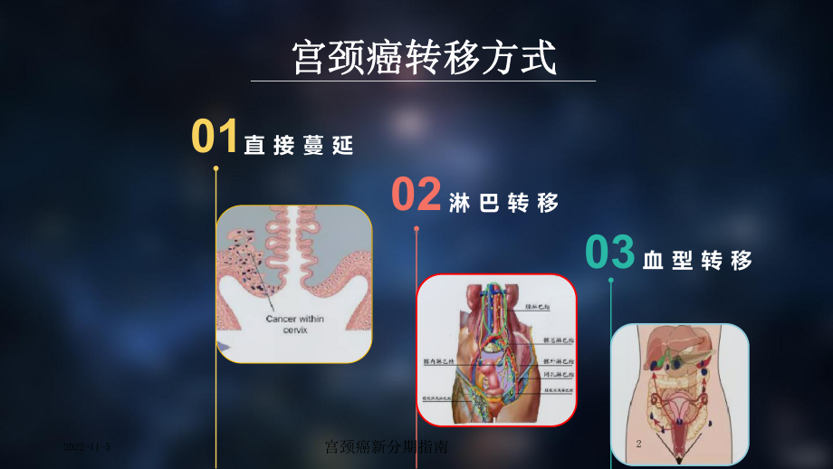 宫颈癌新分期指南培训课件.ppt_第2页