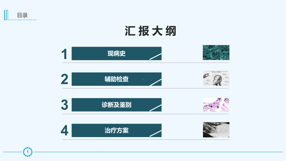 双肺实变伴右侧胸腔积液病例分享课件.ppt_第2页