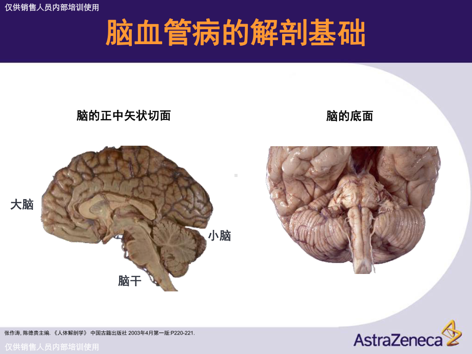 卒中和短暂性脑缺血课件.ppt_第3页