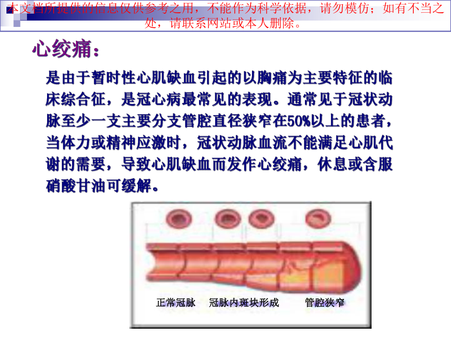 冠心病社区健康管理服务规范培训课件.ppt_第2页