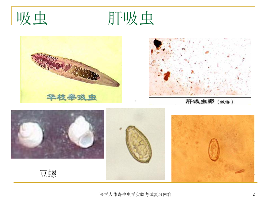 医学人体寄生虫学实验考试复习内容课件.ppt_第2页