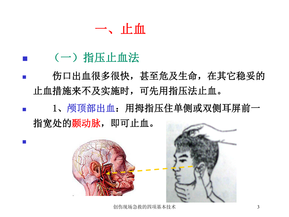 创伤现场急救的四项基本技术培训课件.ppt_第3页