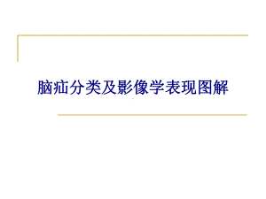 医学脑疝分类及影像学表现图解专题培训课件.ppt