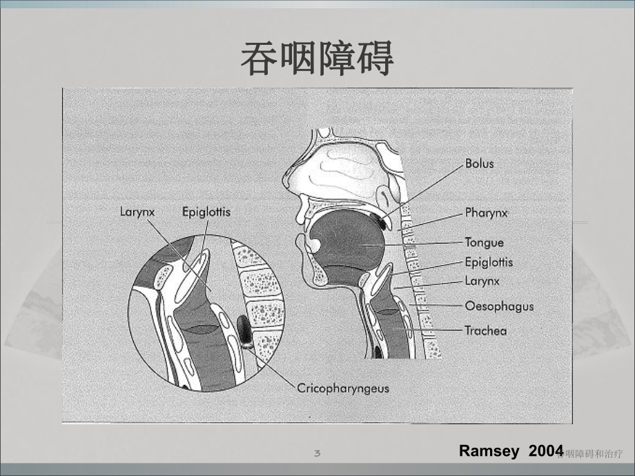 吞咽障碍和治疗培训课件.ppt_第3页