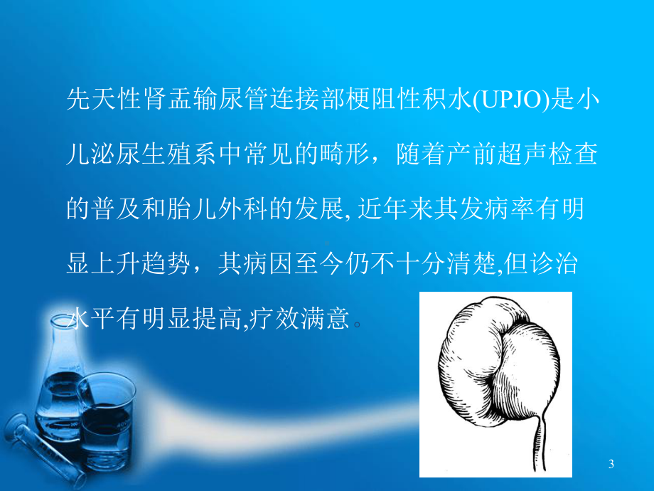 小儿肾积水新进展科普课件.ppt_第3页