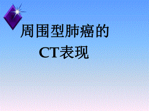 周围型肺癌的ct表现教学课件.ppt