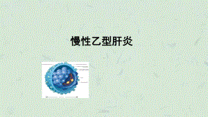 乙型肝炎课件.ppt