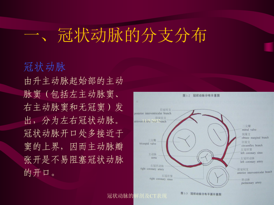 冠状动脉的解剖及CT表现培训课件.ppt_第1页