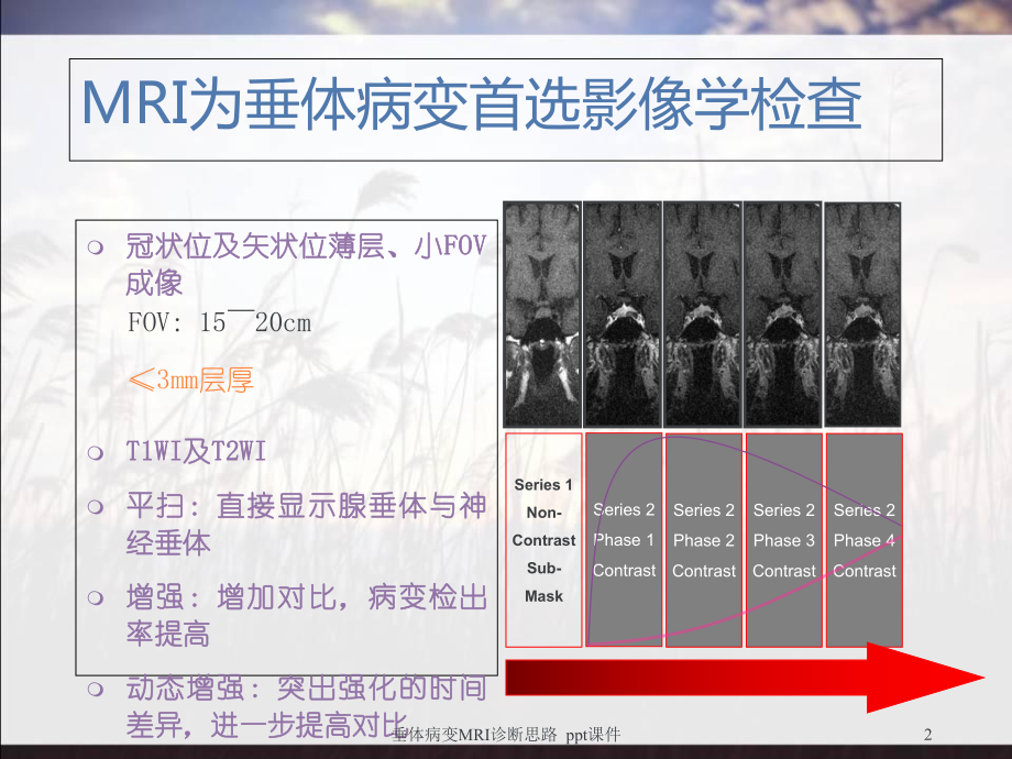 垂体病变MRI诊断思路-课件.ppt_第2页