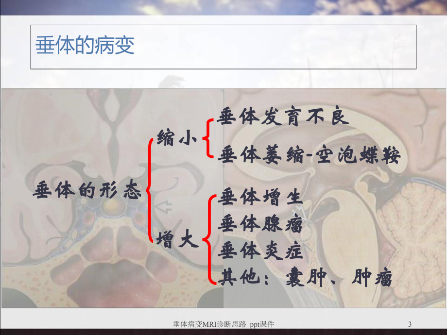 垂体病变MRI诊断思路-课件.ppt_第3页