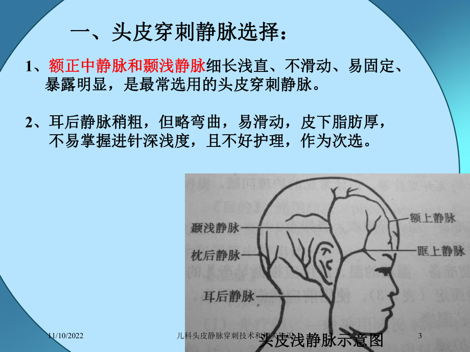 儿科头皮静脉穿刺技术和相关知识课件.ppt_第3页